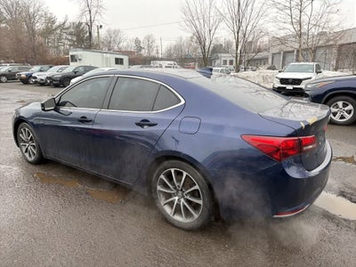 2016 Acura TLX V6 Advance